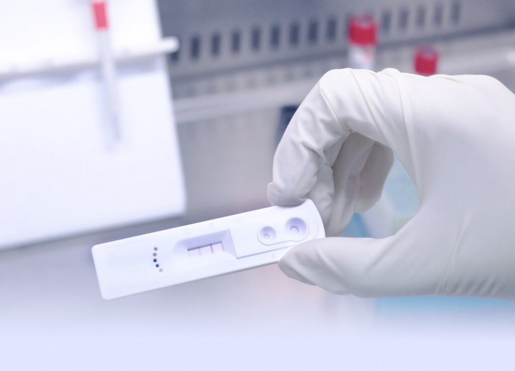 N Health ให้บริการตรวจคัดกรองภูมิคุ้มกันวินิจฉัยโรค COVID-19 แบบรวดเร็ว (Rapid Test) N Health ให้บริการตรวจคัดกรองภูมิคุ้มกันวินิจฉัยโรค COVID-19 แบบรวดเร็ว (Rapid Test)