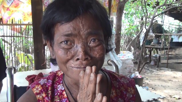 ป้าน้ำตานองหน้า โดนแอบกดเงินไป 5,000 บาท ขณะนั่งรถเข็นมาฟอกไต