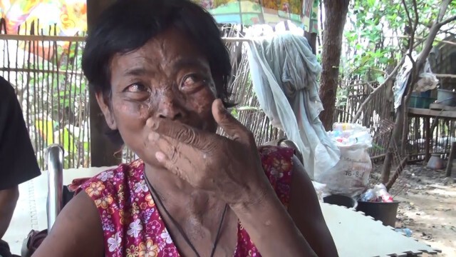 ป้าน้ำตานองหน้า โดนแอบกดเงินไป 5,000 บาท ขณะนั่งรถเข็นมาฟอกไต