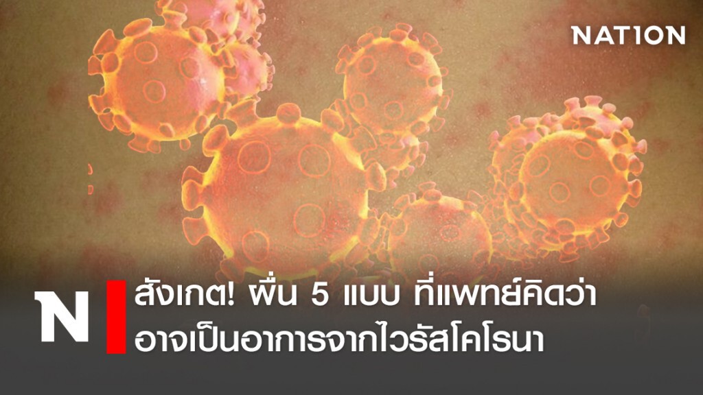 สังเกต!ผื่น 5 แบบ ที่แพทย์คิดว่าอาจเป็นอาการจากไวรัสโคโรนา