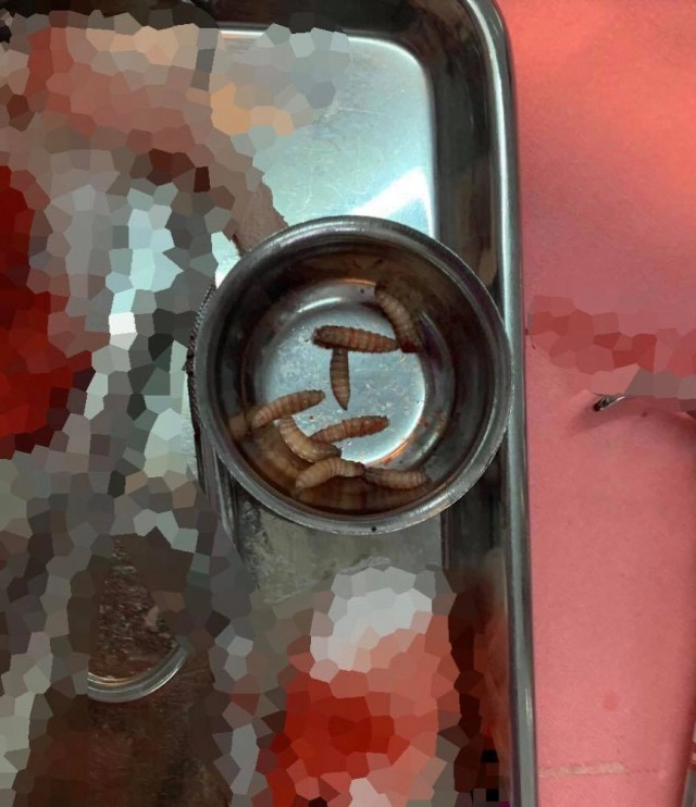 "หมอแล็บ" ไขข้อสงสัย! "หนอนเข้าไปอยู่ในปากได้อย่างไร"