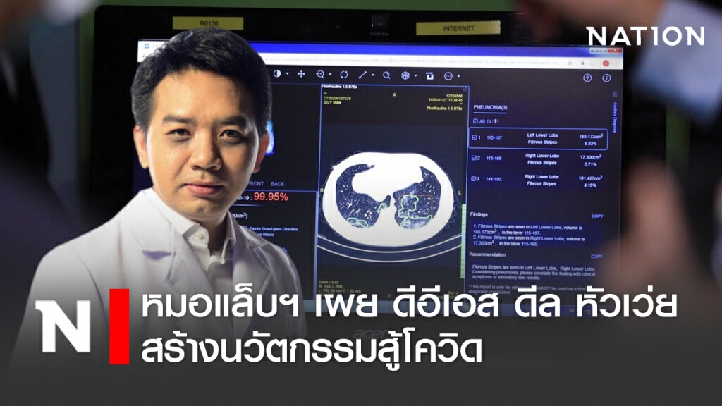 หมอแล็บแพนด้า เผย ดีอีเอส ดีล หัวเว่ย สร้างนวัตกรรมสู้โควิด-19 หมอแล็บแพนด้า เผย ดีอีเอส ดีล หัวเว่ย สร้างนวัตกรรมสู้โควิด-19