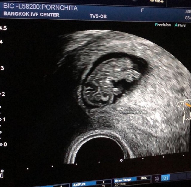 "มิค" ดีใจ "เบนซ์" ตั้งท้องลูกคนที่ 3 แล้ว