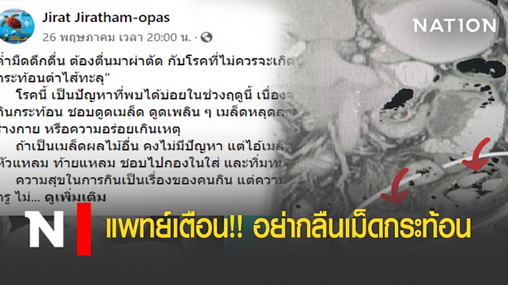 แพทย์เตือน!! อย่ากลืนเม็ดกระท้อน