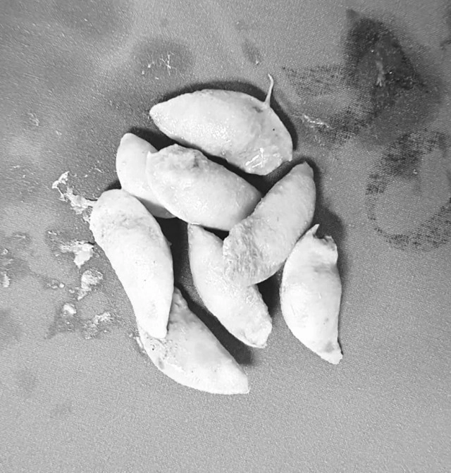 แพทย์เตือน!! อย่ากลืนเม็ดกระท้อน