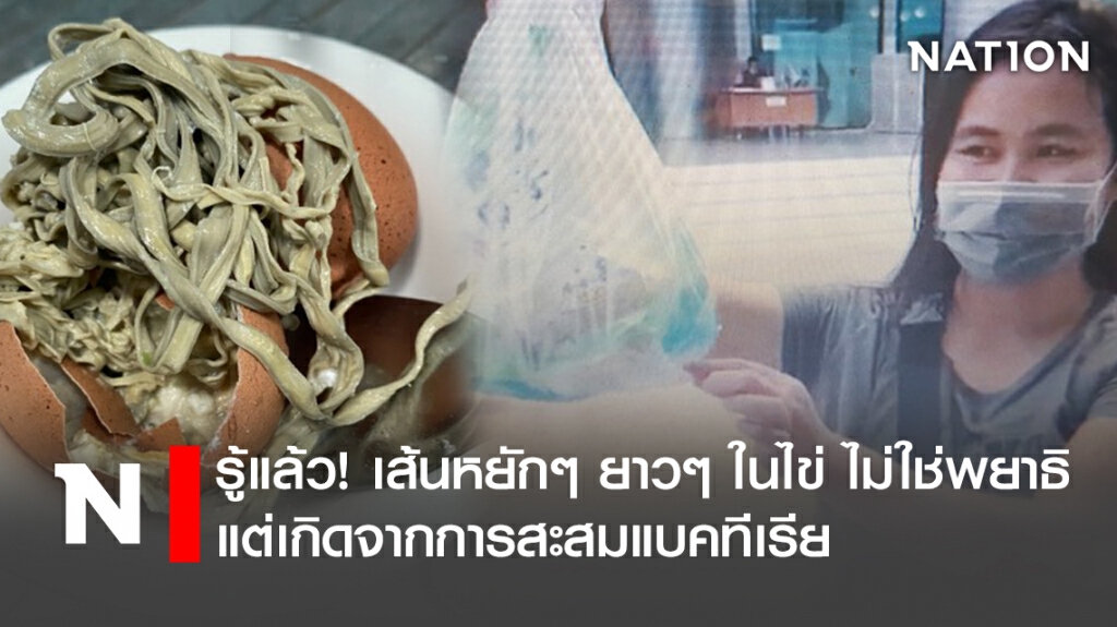 รู้แล้ว! เส้นหยักๆ ยาวๆ ในไข่ ไม่ใช่พยาธิ แต่เกิดจากการสะสมแบคทีเรีย รู้แล้ว! เส้นหยักๆ ยาวๆ ในไข่ ไม่ใช่พยาธิ แต่เกิดจากการสะสมแบคทีเรีย