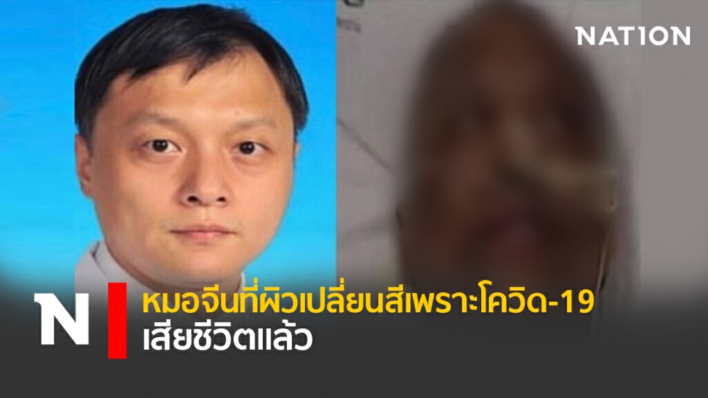 หมอจีนที่ผิวเปลี่ยนสีเพราะโควิด-19 เสียชีวิตแล้ว