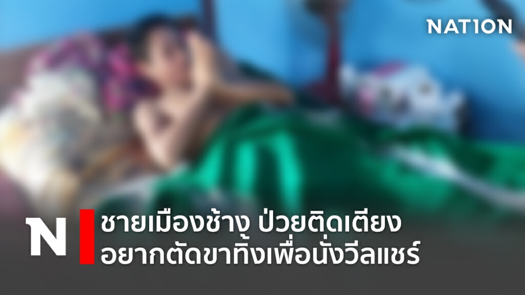 ชายเมืองช้าง ป่วยติดเตียงอยากตัดขาทิ้งเพื่อนั่งวีลแชร์ ชายเมืองช้าง ป่วยติดเตียงอยากตัดขาทิ้งเพื่อนั่งวีลแชร์
