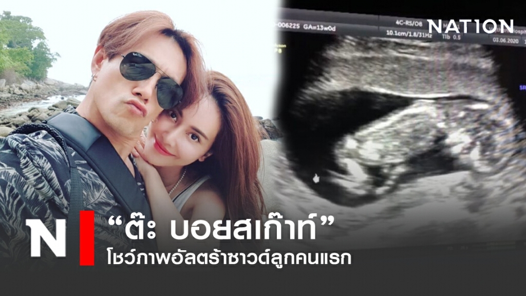 "ต๊ะ บอยสเก๊าท์"  โชว์ภาพอัลตร้าซาวด์ลูกคนแรก