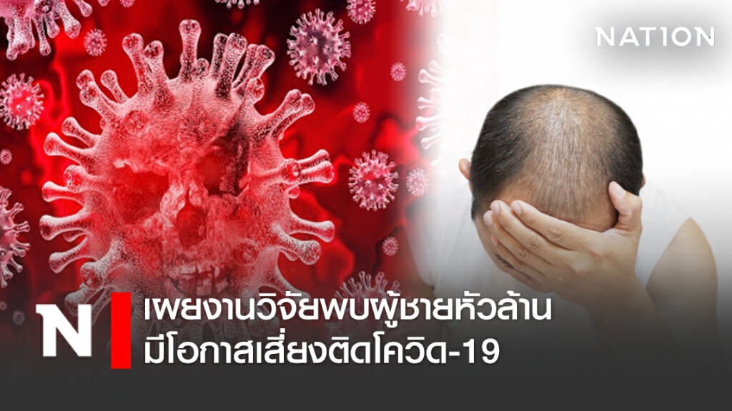 เผยงานวิจัยพบผู้ชายหัวล้าน มีโอกาสเสี่ยงติดโควิด-19