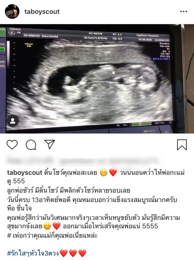 "ต๊ะ บอยสเก๊าท์"  โชว์ภาพอัลตร้าซาวด์ลูกคนแรก