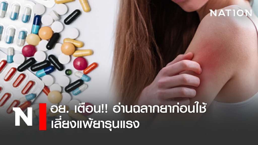 อย. เตือน!! อ่านฉลากยาก่อนใช้ เลี่ยงแพ้ยารุนแรง