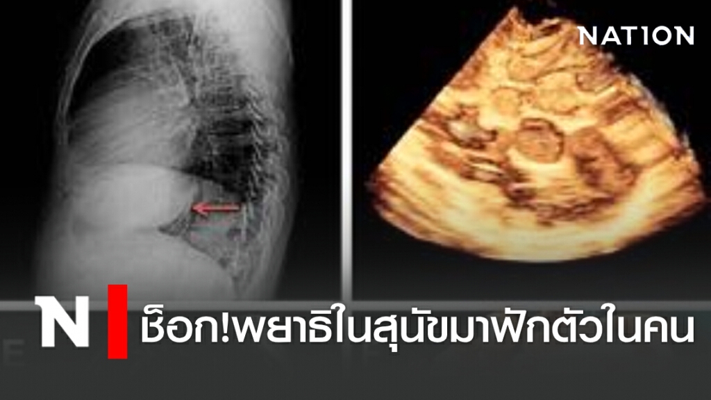 ช็อก!พยาธิในสุนัขมาฟักตัวในคน เตือนต้องรักษาสุขอนามัยทั้งคนและสัตว์เลี้ยง