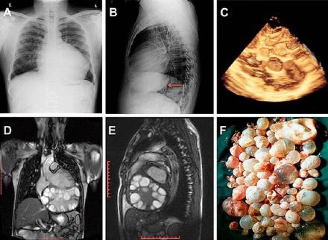 ช็อก!พยาธิในสุนัขมาฟักตัวในคน เตือนต้องรักษาสุขอนามัยทั้งคนและสัตว์เลี้ยง