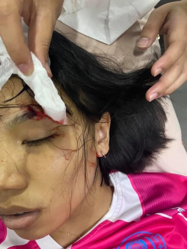 ‘ลิลลี่ ได้หมดถ้าสดชื่น’ ถูกหามส่ง รพ. ล้มหัวฟาดพื้น คิ้วแตกเย็บ3เข็ม