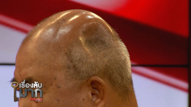 เปิดใจลุงขายข้าวผัดปู ถูกทวงหนี้มหาโหด ทุบกะโหลก! ผวาป้าร้อยล้านไม่ถูกจับ