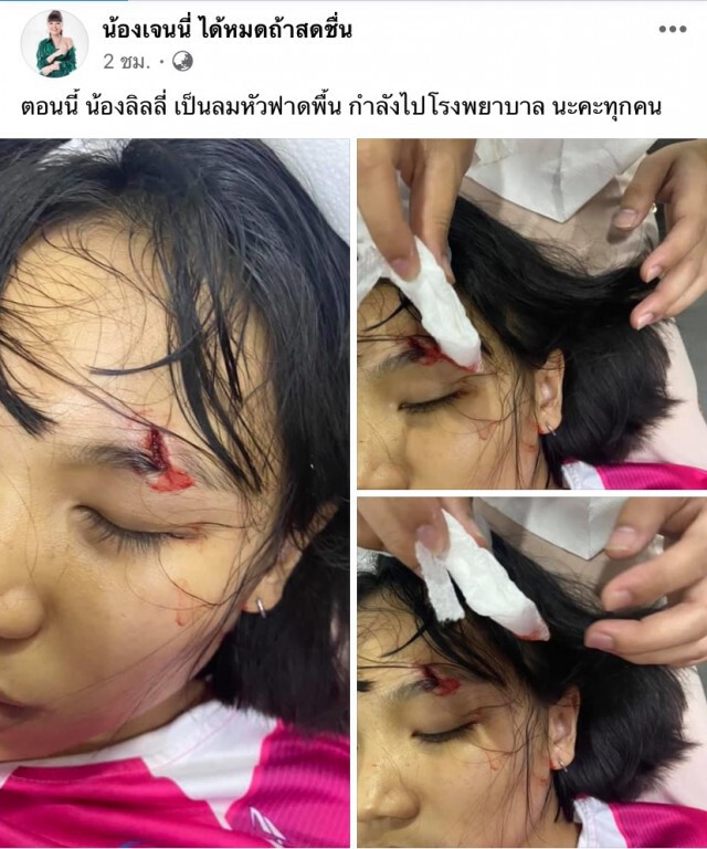 ‘ลิลลี่ ได้หมดถ้าสดชื่น’ ถูกหามส่ง รพ. ล้มหัวฟาดพื้น คิ้วแตกเย็บ3เข็ม