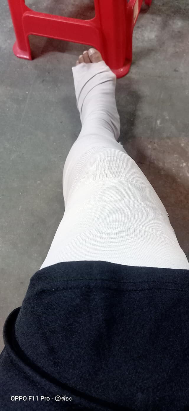 ชายถูกรถชนนอนเจ็บ เจอหญิงหัวร้อนต่อว่าโอเวอร์แอคติ้ง เล่นละครเก่ง