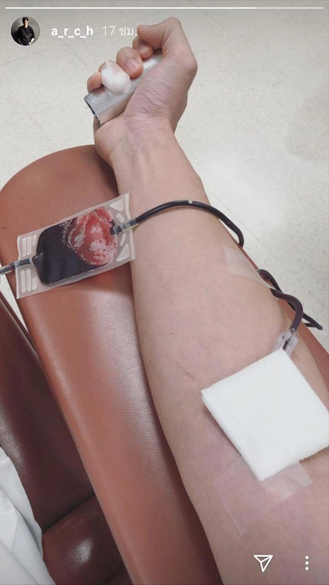 'ต้น อาชว์' แฟนเก่า 'แต้ว ณฐพร' รุดบริจาคเกล็ดเลือด ช่วยคุณพ่อแต้ว