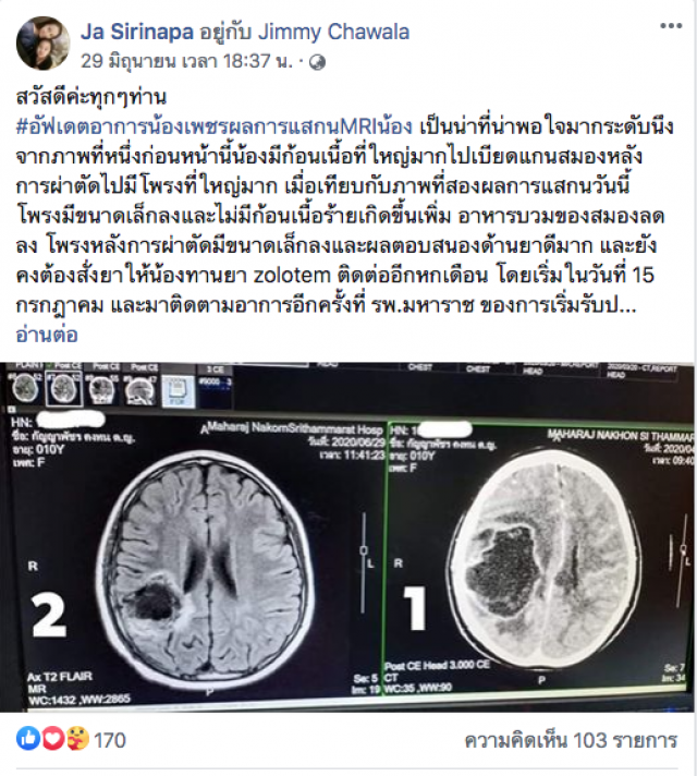 ขอบคุณปะป๊าจิมมี่ เศรษฐีใจบุญเมืองคอนทำซึ้ง ช่วยเด็ก 10 ขวบ ป่วยมะเร็ง