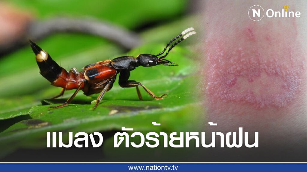 'แมลงก้นกระดก' แมลงตัวร้ายมากับหน้าฝน 'แมลงก้นกระดก' แมลงตัวร้ายมากับหน้าฝน