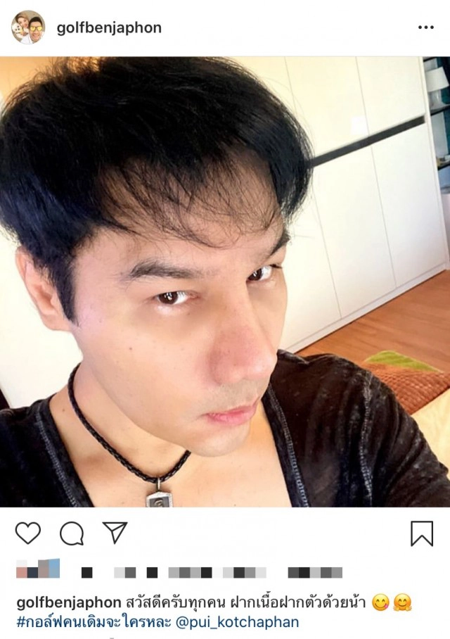 เผยหน้าใหม่‘กอล์ฟ  เบญจพล’หลังทำศัลยกรรม