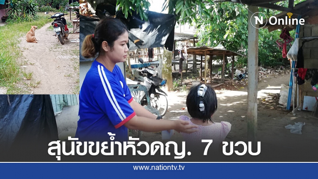 สุนัขขย้ำหัวดญ. 7 ขวบ เจ้าของบิดพลิ้วเบี้ยวจ่ายค่าพยาบาล