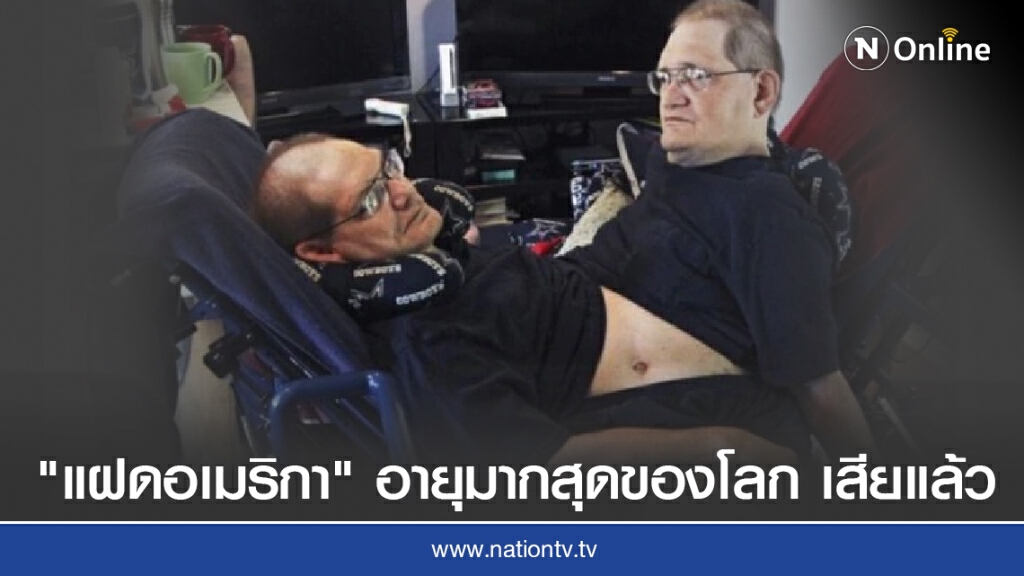 "ฝาแฝด-อเมริกัน" อายุมากที่สุดของโลก เสียชีวิตแล้ว