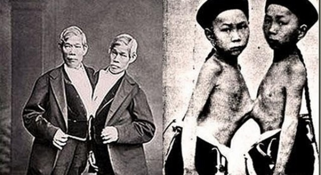 "ฝาแฝด-อเมริกัน" อายุมากที่สุดของโลก เสียชีวิตแล้ว