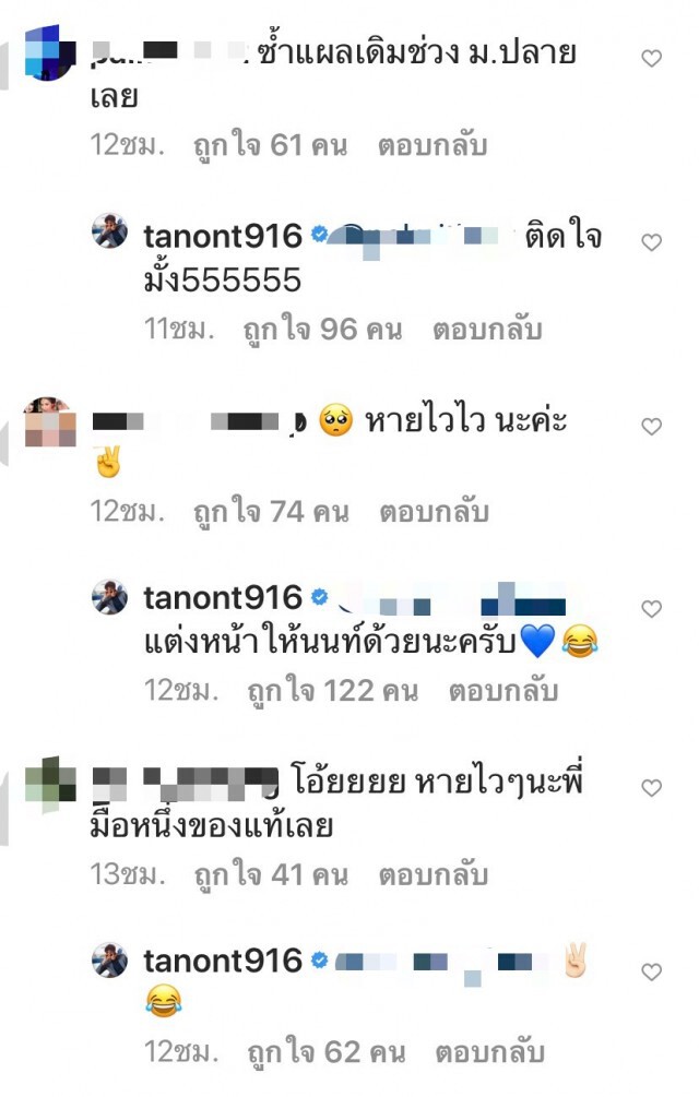 "นนท์-ธนนท์" ล้มแขนหัก!