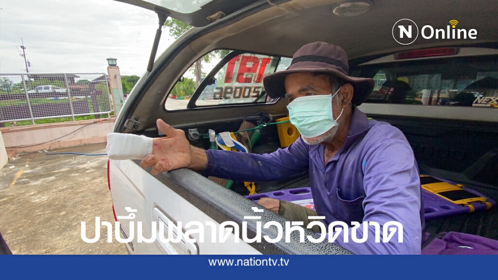 อุทาหรณ์ชาวนาปาระเบิดปิงปองไล่นกในนา พลาดบึ้มคามือนิ้วหวิดขาด อุทาหรณ์ชาวนาปาระเบิดปิงปองไล่นกในนา พลาดบึ้มคามือนิ้วหวิดขาด