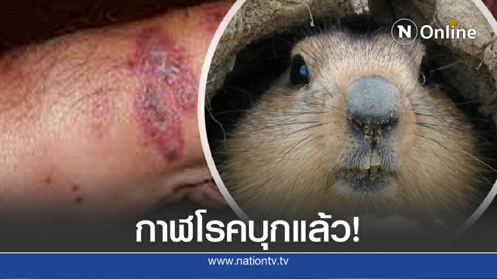 มองโกเลียยันชัดพบเด็กตายจากกาฬโรค-สหรัฐฯพบกระรอกติดเชื้อ หวั่นแพร่สู่มนุษย์