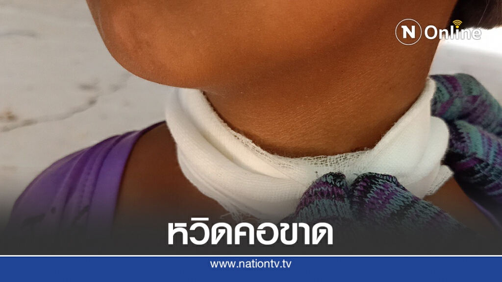 อุทาหรณ์เชือกไนล่อนสายสิญจน์ปาดคอเด็กหญิงหวิดขาด อุทาหรณ์เชือกไนล่อนสายสิญจน์ปาดคอเด็กหญิงหวิดขาด