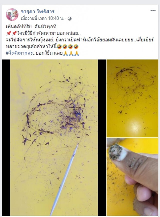 กองทัพเหาบุกหัวเด็กหญิง ถามชาวเน็ต แนะวิธีกำจัด