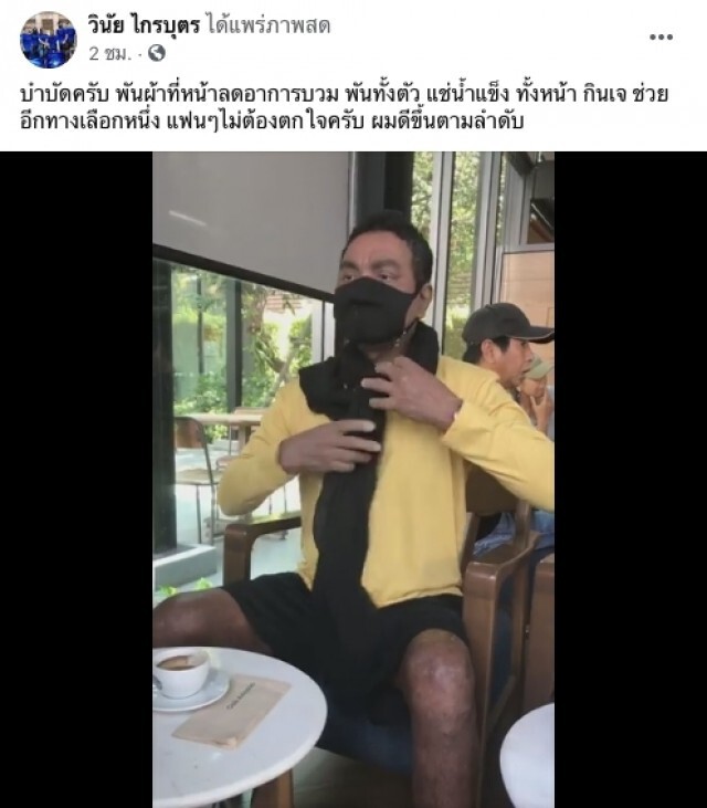 เมฆ วินัย โพสต์พันผ้าทั้งหน้าทั้งตัว ไม่ต้องตกใจอาการดีขึ้นตามลำดับ