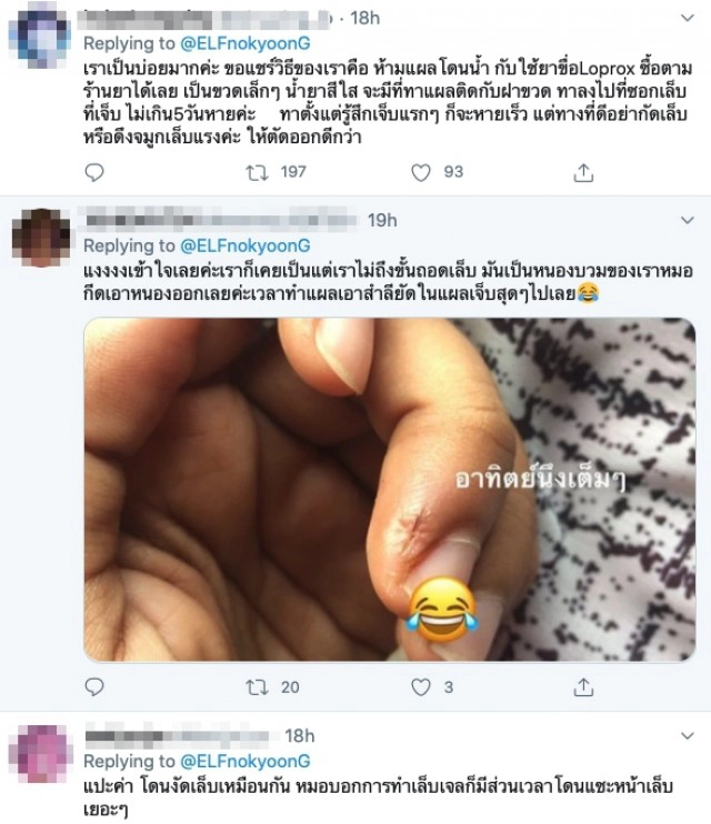 สาวโพสต์เตือนหนองขึ้น เชื้อโรคเข้าเหตุจากดึงจมูกเล็บ