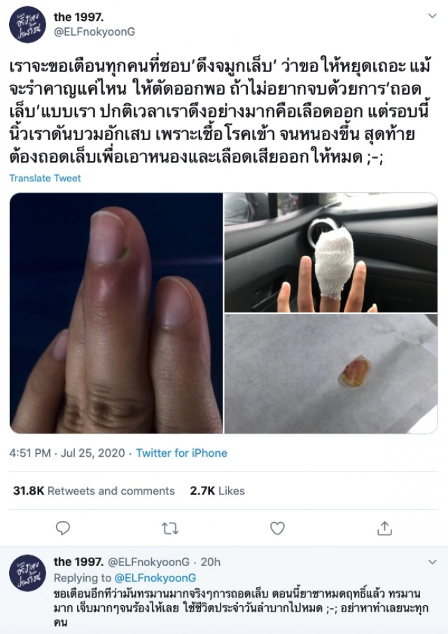 สาวโพสต์เตือนหนองขึ้น เชื้อโรคเข้าเหตุจากดึงจมูกเล็บ