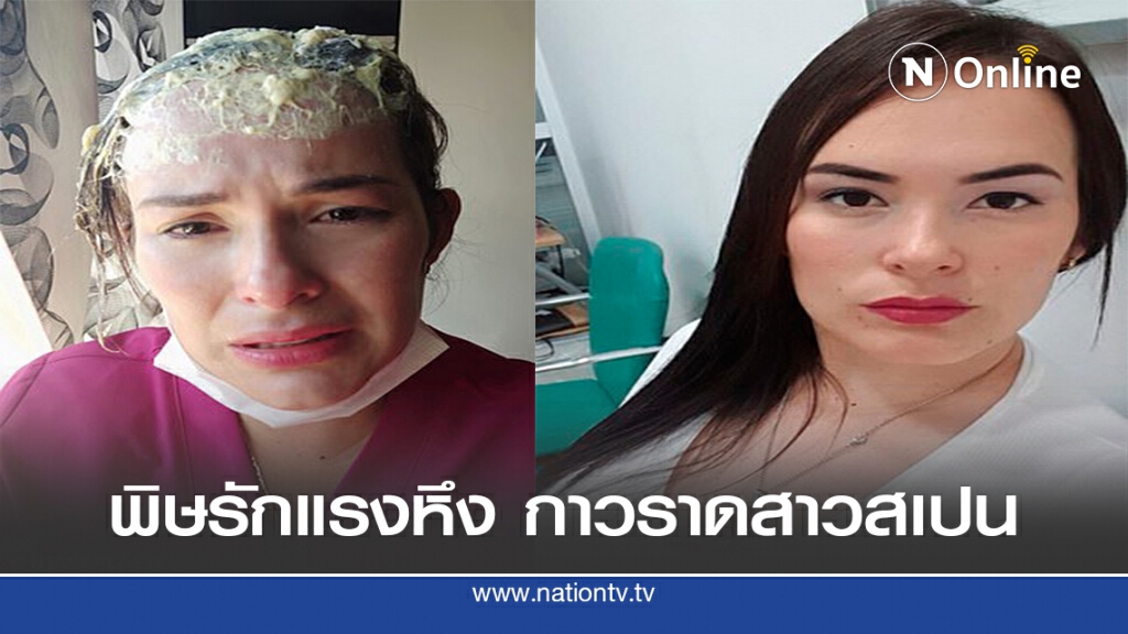 พิษรักแรงหึง สาวถูกกาวราดหัว