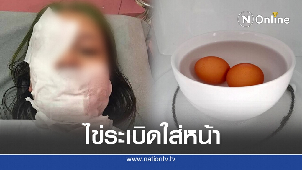 สาวหวิดเสียโฉม หลังเวฟไข่ในไมโครเวฟ สุดท้ายระเบิดใส่หน้า