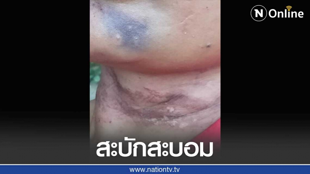 มูลนิธิปวีณาฯช่วยสาวลูก2ถูกผัวซ้อม