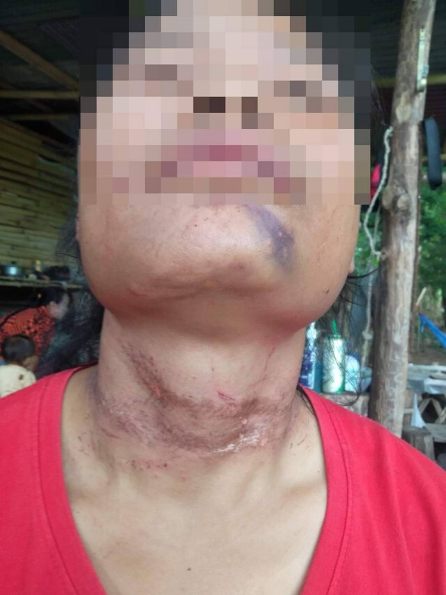 มูลนิธิปวีณาฯช่วยสาวลูก2ถูกผัวซ้อม