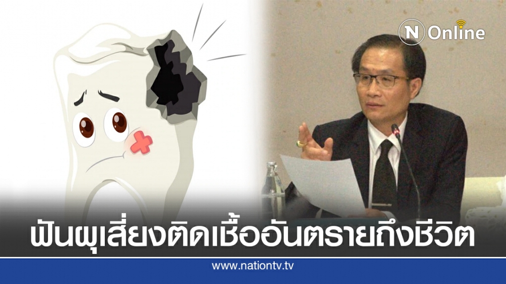 แพทย์เตือนฟันผุ เสี่ยงติดเชื้อ อันตรายถึงชีวิต