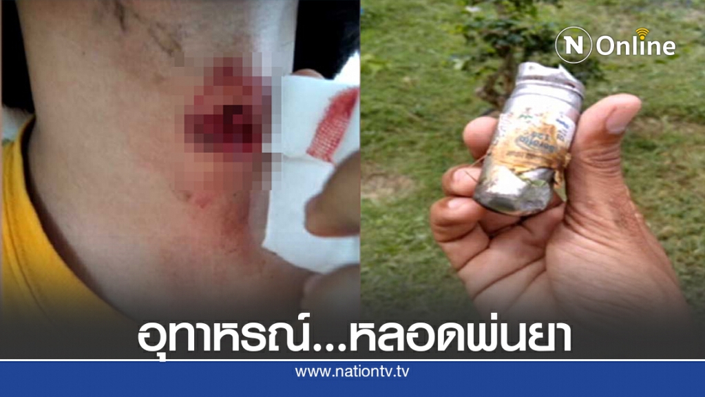 หลอดยาพ่นหอบหืดบึ้มใส่คอเหวอะ หลอดยาพ่นหอบหืดบึ้มใส่คอเหวอะ