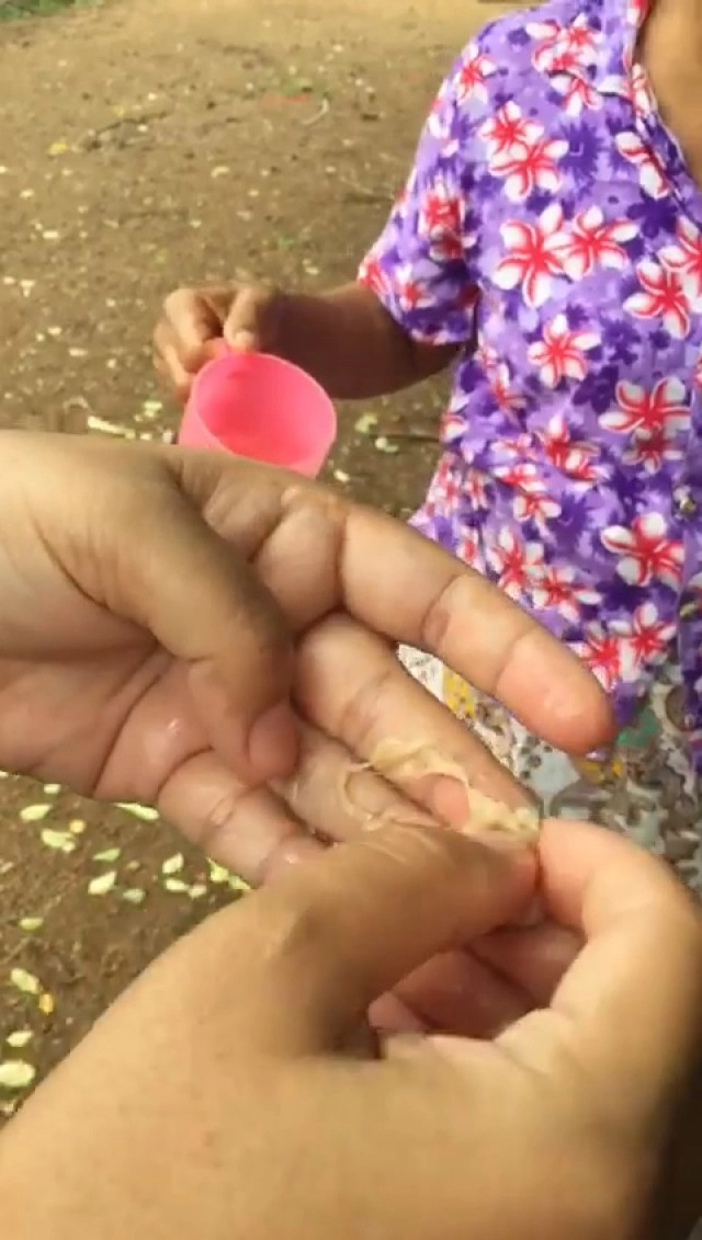 ชาวบ้านเปิดคลิปขนมจีนลวงโลก เจอทิชชู่ในน้ำยา ช้อนมาเต็มๆตาเป็นก้อน