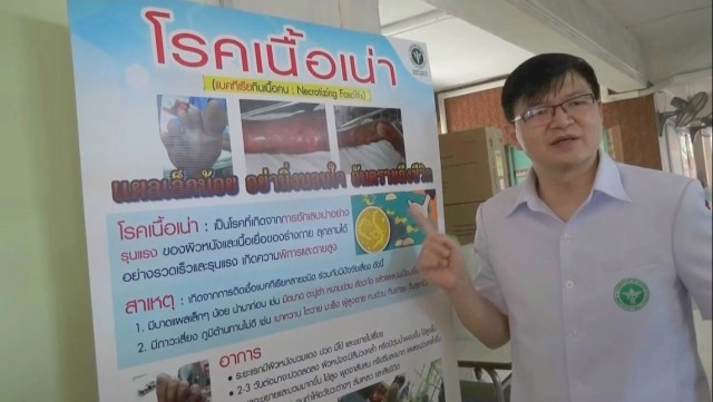 เตือน"โรคเนื้อเน่า"-แบคทีเรียกินเนื้อคน