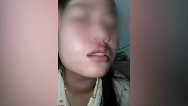 สาวรีวิว ทำปากกระจับด้วยวิธีธรรมชาติ ชาวเน็ตแห่คอมเมนต์ เก็บตังค์เหอะ