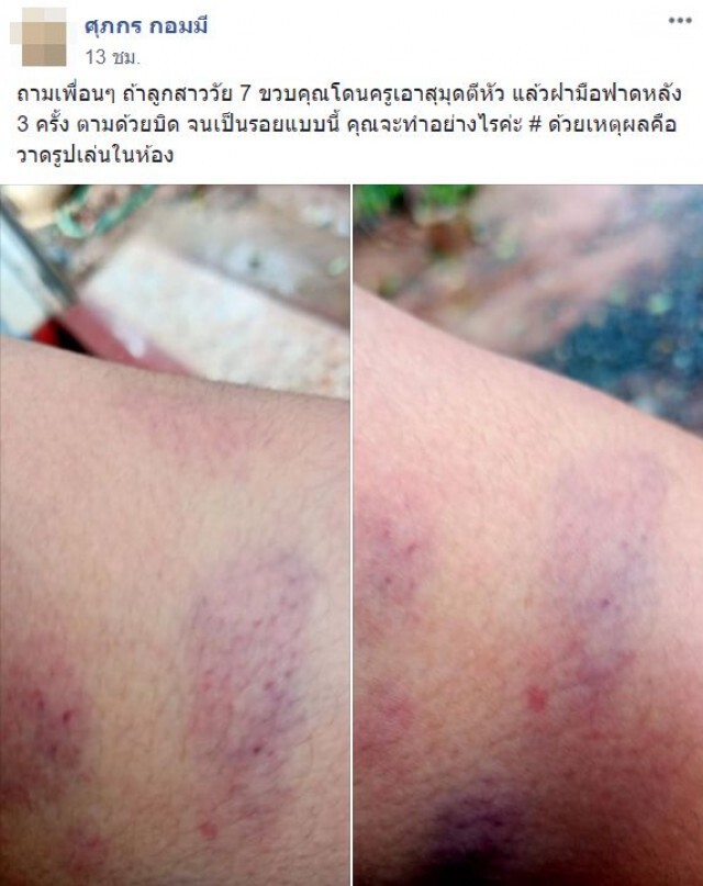 แม่โวยครูเอาสมุดตีหัวฝ่ามือฟาดหลังลูก7 ขวบเป็นรอยเขียว