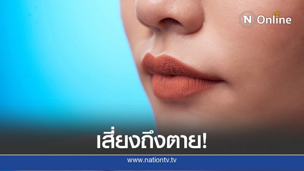 แพทย์ผิวหนังเตือนอย่าให้ผึ้งต่อยปากหวังเป็นรูปกระจับ เสี่ยงอันตรายอาจตายได้
