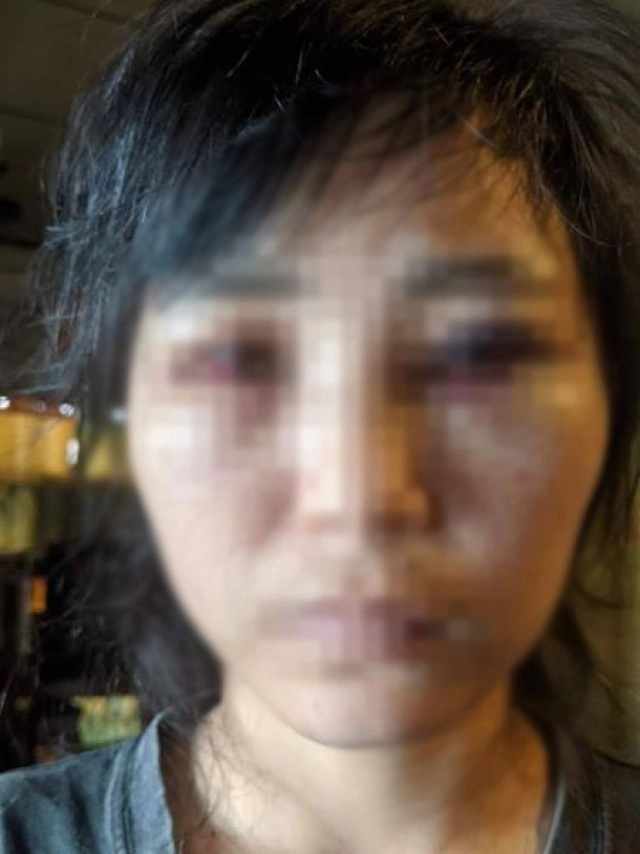 สาวร้อง ถูกทำร้ายร่างกายจนดั้งหัก บอบช้ำหนัก จากชายที่เรียกว่าลูกค้า