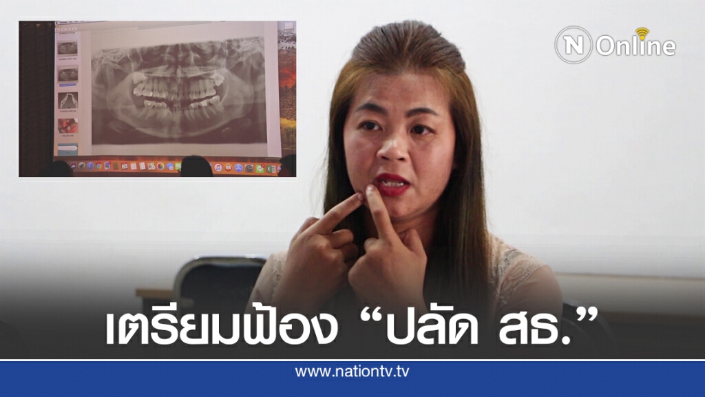 คนไข้ถูกลืมหัวกรอฟันในเหงือก เตรียมฟ้องปลัด สธ. เรียกค่าเยียวยา
